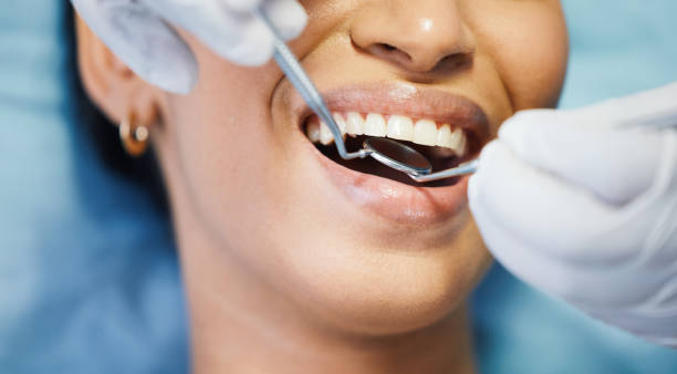 Best Urgent Care for Lost Fillings or Crowns in Orion, IL
