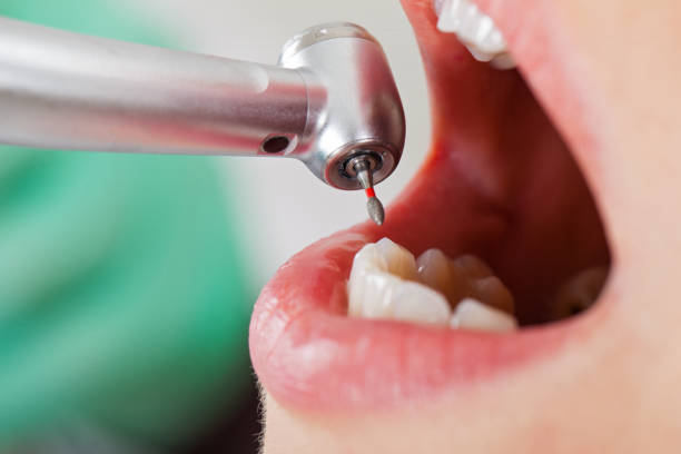 Best Emergency Treatment for Dental Infections or Abscesses in Orion, IL